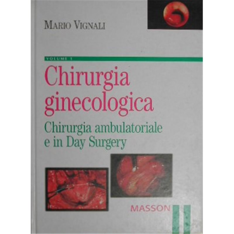 Chirurgia ginecologica - VOLUME 1 Chirurgia ambulatoriale e in Day Surgery